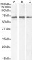 Goat Anti-PCK2 / PEPCK-M Antibody